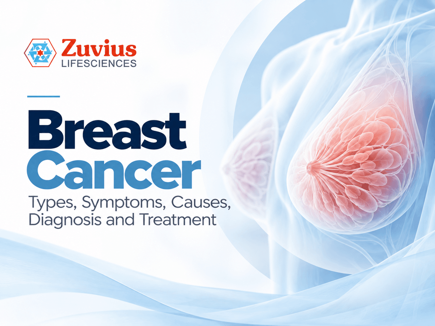 Breast Cancer: Symptoms, Types, Causes, Diagnosis and Treatment