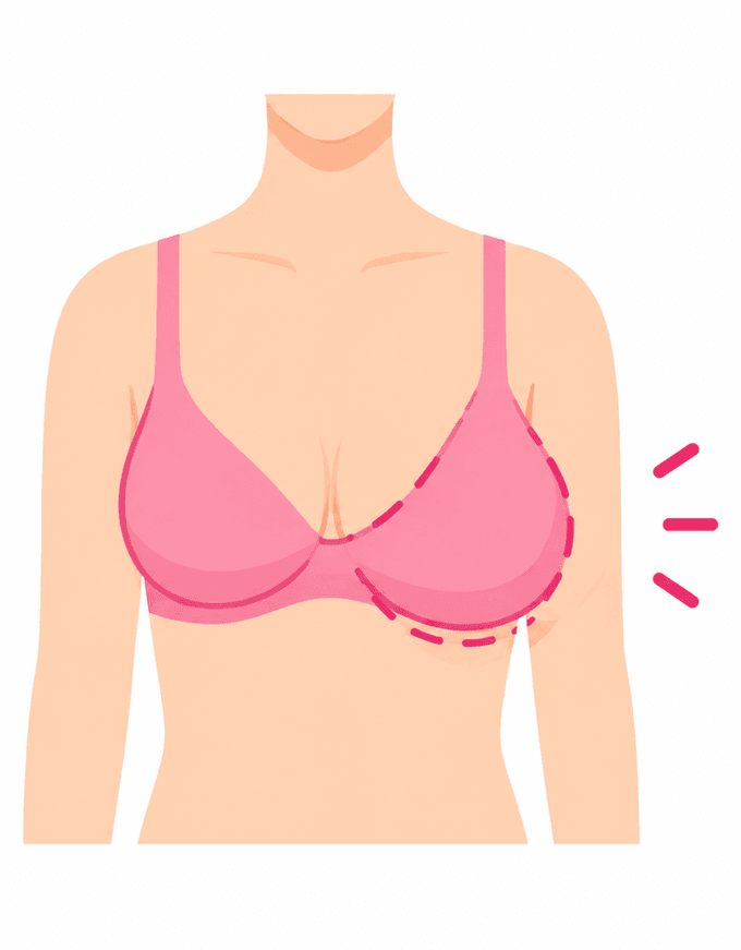 Changes in Breast Size or Shape